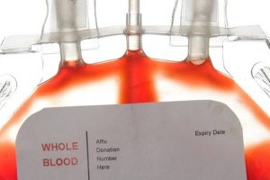 用于一次性生物处理系统分析的血袋图像。